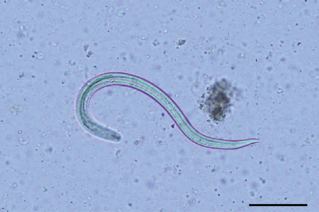 Rat lungworm (Angiostrongylus cantonensis) infective third-stage larva (L3) taken from a bubble pond snail (Bullastra lessoni). Scale bar = 100 µm. Credit: P. Rivory