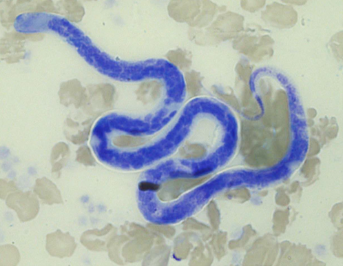 Acanthocheilonema reconditum as seen within a canine blood smear