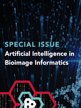 AI in Bioimage Informatics