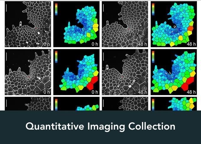 Quantitative Imaging Collection