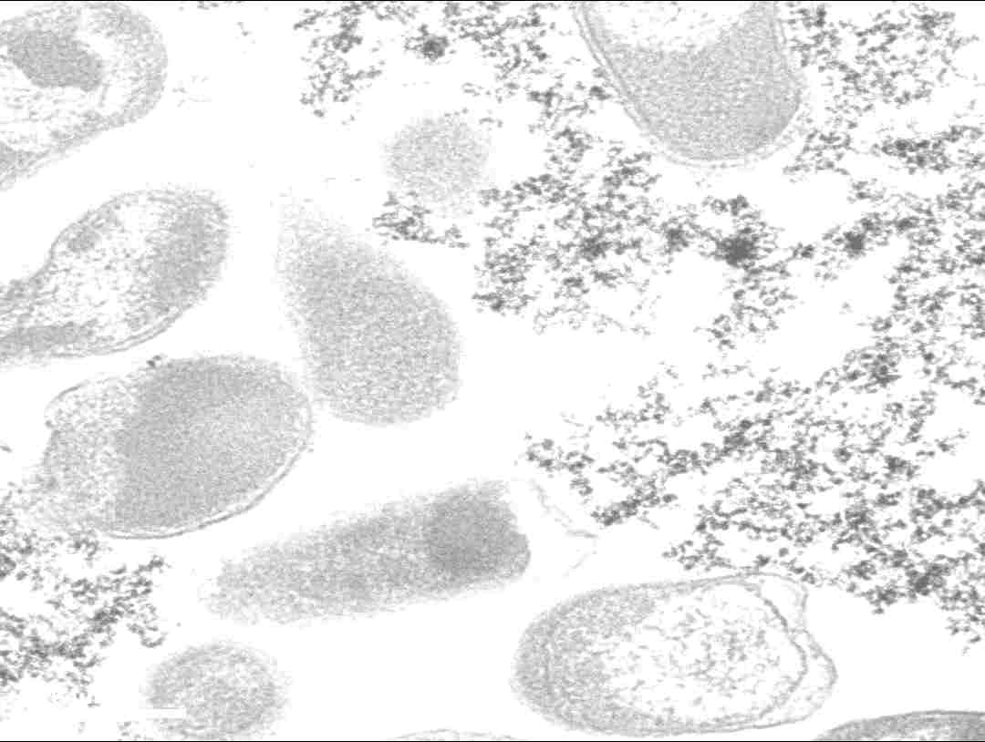 Critical Metals - GBI Collection Image